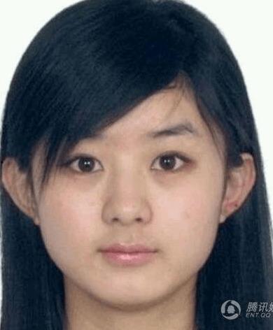 明星网红整形前照照片,揭秘网红整形前后的惊人蜕变！